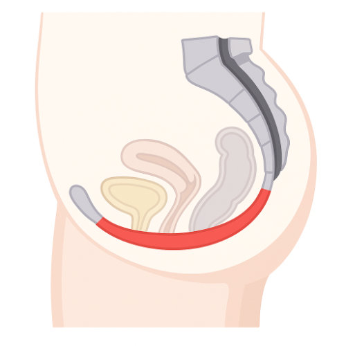 Nach der Beckenbodenbehandlung